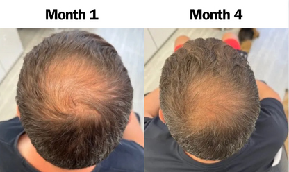 Activation Hair Growth Serum